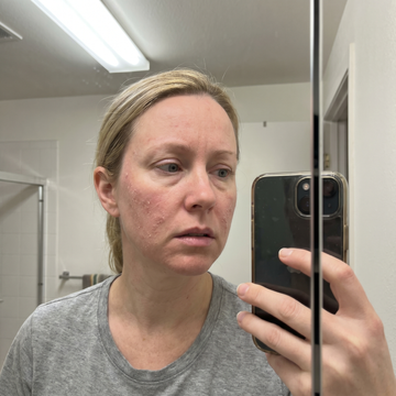 Amanda before